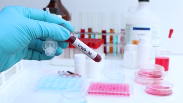 Prueba de varicela para buscar anormalidades de la sangre, experimento científico - Metraje, vídeo