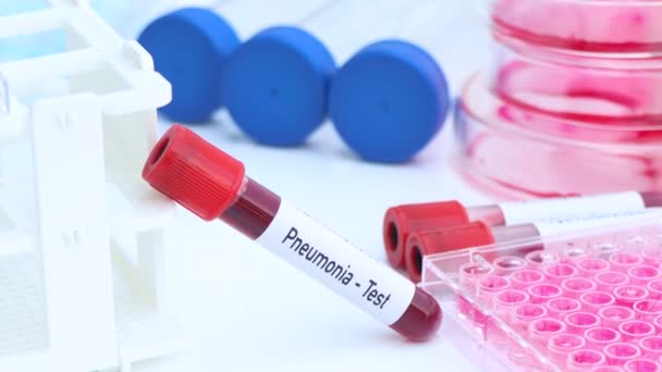 Test de pneumonie pour rechercher des anomalies du sang, expérience scientifique - Séquence, vidéo