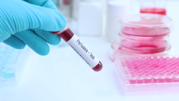 Test de coqueluche pour rechercher des anomalies du sang, expérience scientifique - Séquence, vidéo