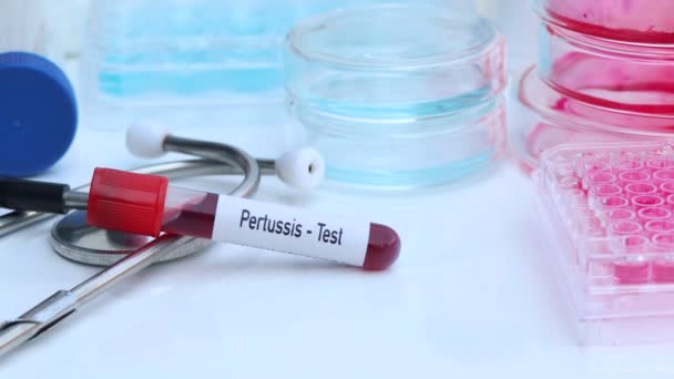 Prueba de tos ferina para buscar anomalías en la sangre, experimento científico - Imágenes, Vídeo