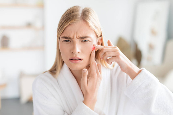 Acne issue. Unhappy blonde young lady in white robe looking at mirror checking facial skin, touching her cheek and squeezing pimples with concerned face, at home bathroom interior - Photo, Image