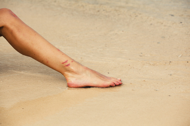 Нога жінки з вирізаними з коралів
 - Фото, зображення