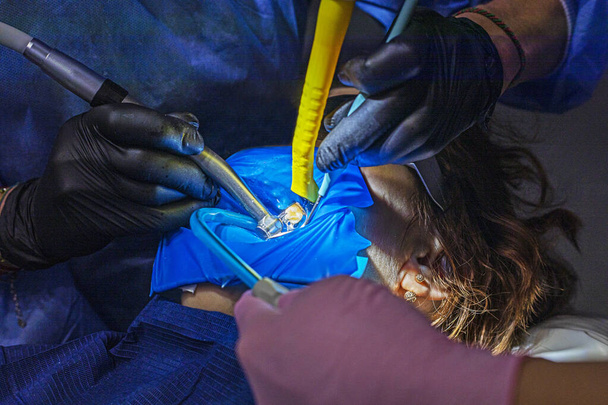 Dentysta w czarnych rękawiczkach leczy chorego zęba. - Zdjęcie, obraz
