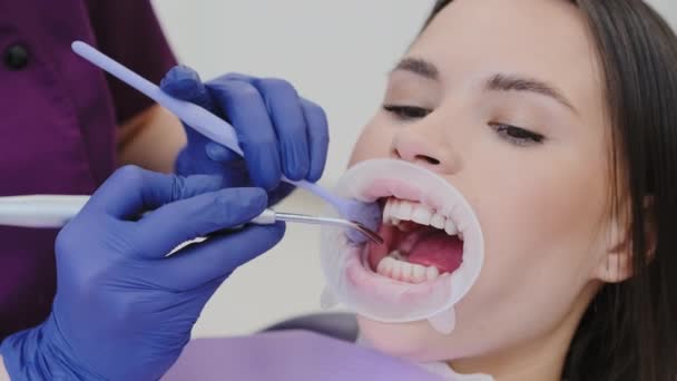 Vrouwelijke tandarts blaast lucht over tanden drogen oppervlak van speeksel voor verdere controle. Tandarts bereidt voor op tandheelkundig onderzoek van mondholte - Video