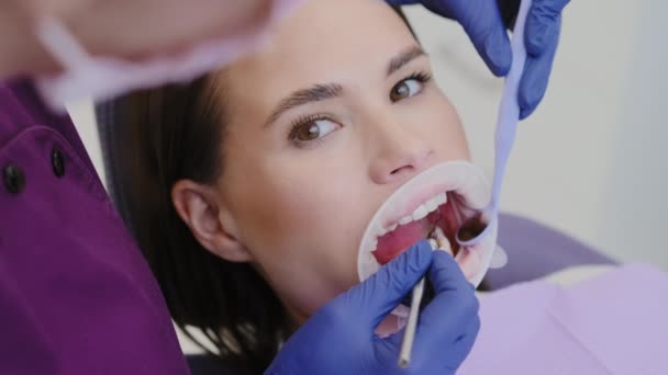 Vrouwelijke patiënt ondergaat regelmatige tandheelkundige controle in het ziekenhuis. Vakkundige tandarts in masker controleert de sterkte van de bovenste tanden met tandheelkundig gereedschap op afspraak - Video