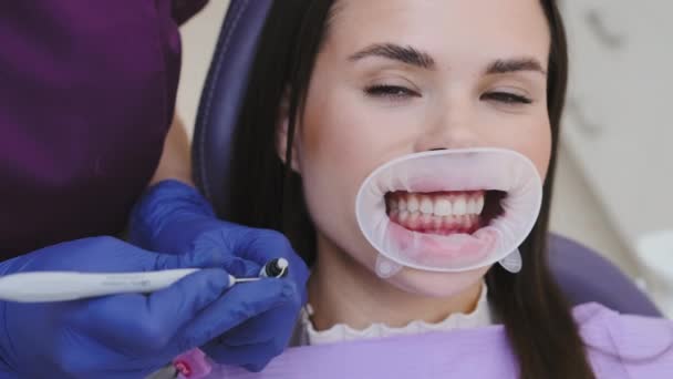 Tandheelkundige professional bereidt vulmateriaal het nemen van de nodige hoeveelheid met tandsonde gereedschap. Tandheelkundige vulprocedure in prive kliniek - Video