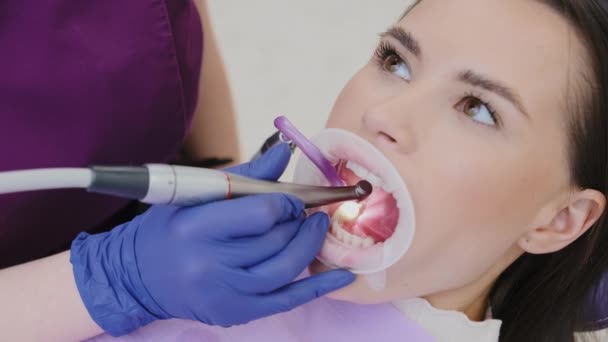 Vakkundige vrouwelijke tandarts in handschoenen verwijdert beschadigd deel van de tand met gebitsboor. Behandeling van holtes in particuliere tandheelkundige kliniek - Video