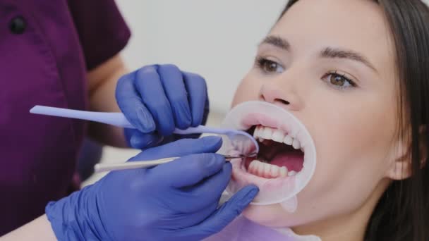 A nő fogászati kezelésen esik át a klinikán. Női fogorvos kesztyűben aprólékosan ellenőrzi a fogak szilárdságát speciális eszközökkel - Felvétel, videó