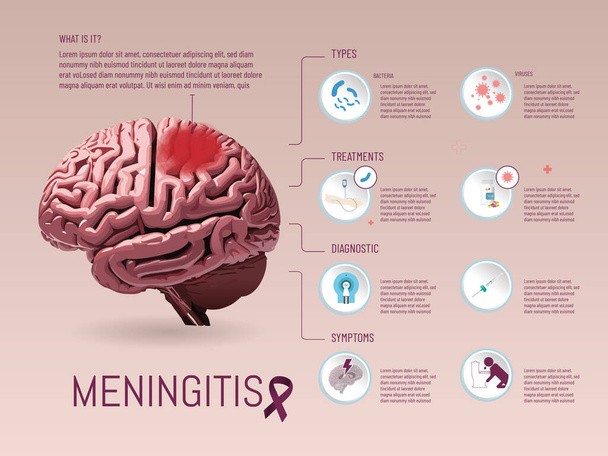 Infografica su meninguite, sintomi, trattamenti, tipi, immagine cerebrale creata con AI, su sfondo tinta unita, e icone aggiunte con illustratore. - Vettoriali, immagini