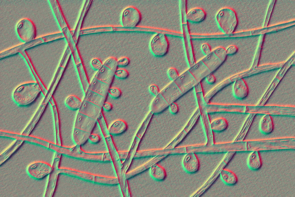 Fungus Trichophyton rubrum, 3D ілюстрація, що показує макроконідіум, мікроконідію та гіфеї перегородки. Інфікує шкіру і нігті, викликаючи дерматофітоз. - Фото, зображення