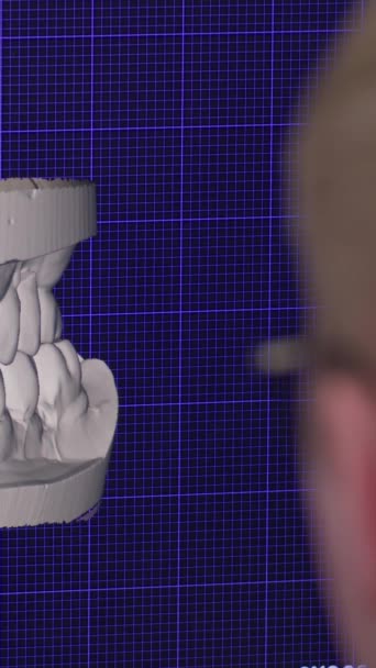 Вертикальне відео. Програма на комп'ютерному дисплеї, що використовується стоматологом для реставрації зубів. Програма Проектування протезів для лікування. - Кадри, відео