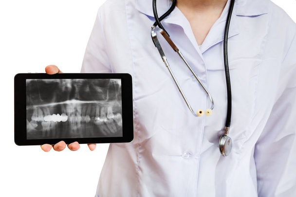 Enfermera sostiene la tableta PC con imagen de rayos X de las mandíbulas
 - Foto, imagen