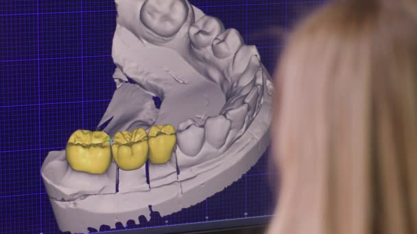 Um programa em um monitor de computador usado por uma técnica odontológica feminina para dentes protéticos. Programa de desenho de próteses dentárias para tratamento. - Filmagem, Vídeo