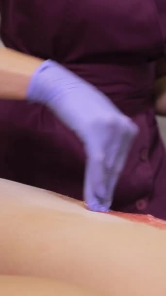 Egy nő viasszal távolítja el a szőrt egy férfi lábáról, a kezével alkalmazza, és az ujjaival simítja a bőrre. Függőleges videó - Felvétel, videó