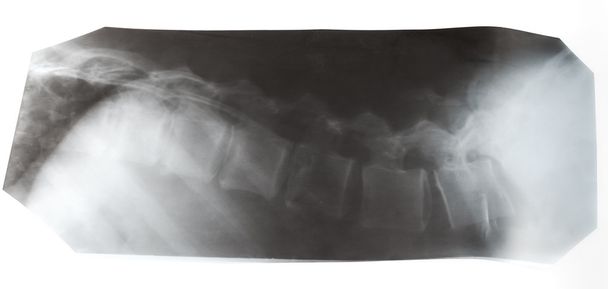 Imagen de rayos X de columna vertebral humana aislada
 - Foto, imagen
