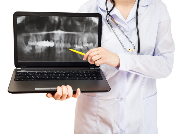 Krankenschwester zeigt auf Computer-Laptop mit menschlichem Kiefer - Foto, Bild