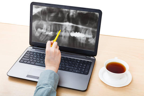 Le dentiste analyse l'image radiographique des mâchoires sur un ordinateur portable
 - Photo, image