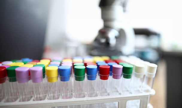 Testbuizen met gekleurde doppen zijn in het laboratorium. Testresultaten voor het coronavirus. Virologisch laboratorium. Aangepast voor speciale experimenten en onderzoek. Analytische of sanitaire stations - Foto, afbeelding