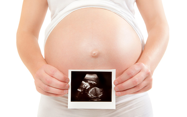 вагітна жінка тримає ультразвукову картину
 - Фото, зображення