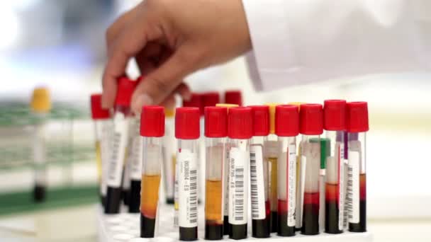 Blood test tubes being analyzed and interchanged by a laboratory worker - Πλάνα, βίντεο