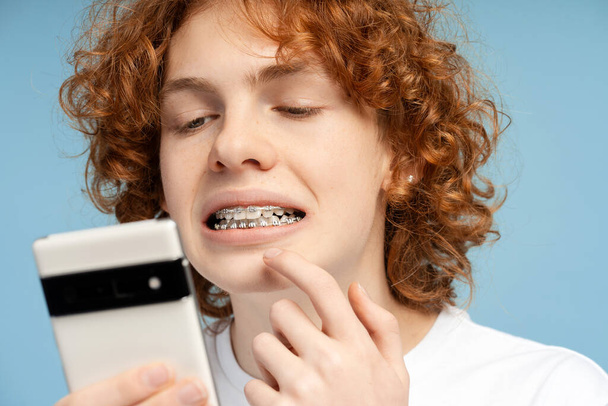 Portret van gekrulde gember tiener met beugels met smartphone, kijkend in frontale camera geïsoleerde blauwe achtergrond. Begrip tandheelkundige verzorging  - Foto, afbeelding