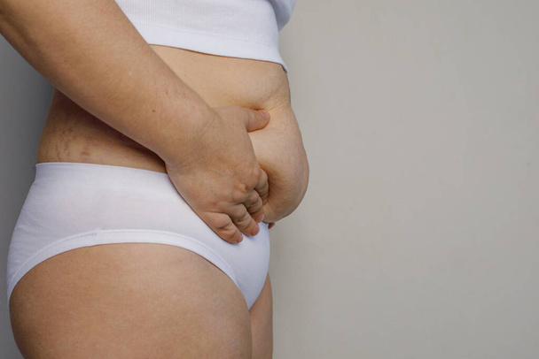 Female stomach, profile. Woman hand holding excessive stomach belly fat closeup. Overweight, fatness, oversized, diet and weight loss concept - Photo, Image