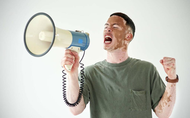 Sprechen Sie, auch wenn Ihre Stimme zittert. Studioaufnahme eines jungen Mannes mit Vitiligo mit einem Megafon vor weißem Hintergrund - Foto, Bild