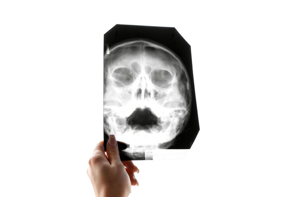 Röntgen des Kopfes. Fluorographie der Kieferhöhlen. Konzept der Medizin. - Foto, Bild