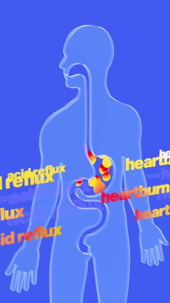 3D Animation der Speiseröhre und des Magens mit Magenreflux und Brennen. Mit Feuerkreisen und den Wörtern "Säurerereflux" und "Sodbrennen", die sich nach oben bewegen. Transparentes Glas-Verdauungssystem auf blauem Hintergrund. - Filmmaterial, Video