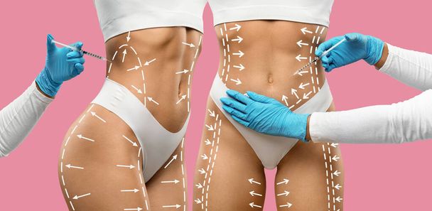 Kosmetische Verfahren zur Körpermodellierung. Behandschuhte Hände von Ärzten, die eine kosmetische Injektion an markierten Körpern von Patientinnen durchführen, rosa Hintergrund, Konzept der kosmetischen Chirurgie und Körperkonturierung - Foto, Bild