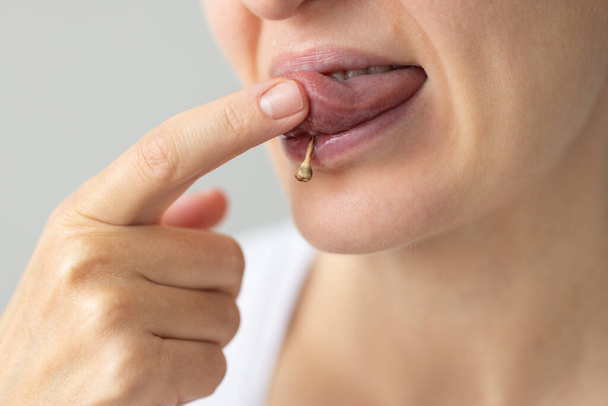 Femme avec piercing sur la langue avec plaque sur les bijoux. Concept de soins buccodentaires - Photo, image