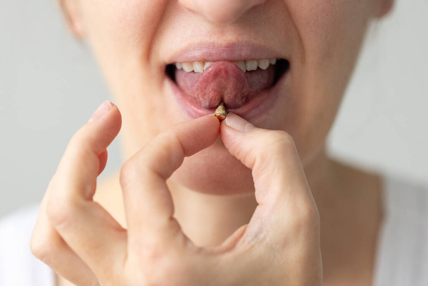 Femme avec perçage sur la langue avec plaque sur la surface du bijou. Concept de soins buccodentaires - Photo, image