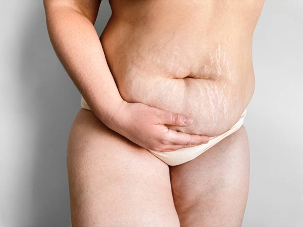 Післяпологовий жіночий середній розріз, що показує розтяжки, позитивність тіла і реальний пост вагітності змінює концепцію. Високоякісна фотографія - Фото, зображення