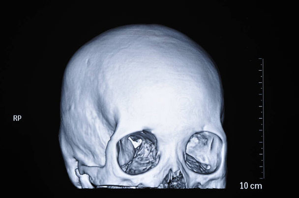 Tomografia ludzkiej czaszki - Zdjęcie, obraz