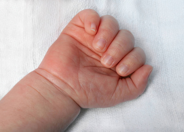 Χέρι νεογέννητου μωρού. Χέρι σε μια γροθιά με δάχτυλα, καρφιά και παλάμη σε ένα αποστειρωμένο ύφασμα. Ιστορικό. - Φωτογραφία, εικόνα