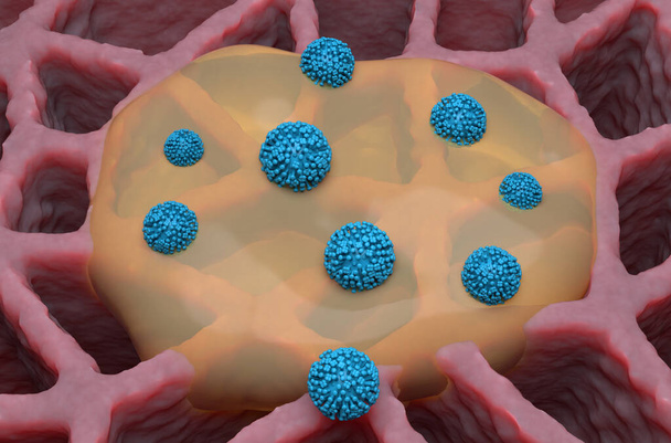 Influenza (gripe) vírus e muco no pulmão - ilustração 3d vista isométrica - Foto, Imagem
