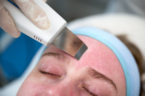 Nahaufnahme der Hautreinigung und des Gesichtspeelings in der Schönheitsklinik. Tiefenporenreinigung - Foto, Bild
