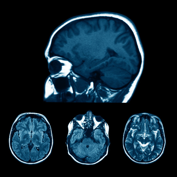 MRI skenování - Fotografie, Obrázek