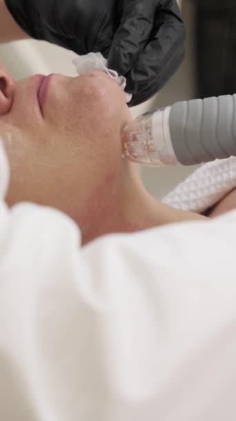 kozmetológus végez RF emelő eljárás a nők nyak - Felvétel, videó