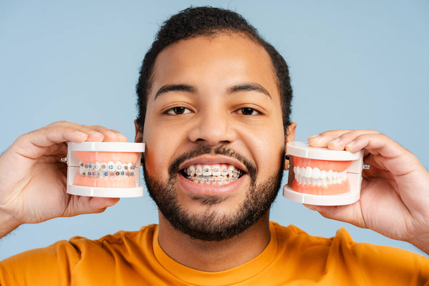 Photo portrait rapprochée d'un homme afro-américain souriant avec des attelles orthodontiques, tenant des modèles de mâchoires en plastique avec des supports, isolé sur un fond de studio bleu. Concept de santé dentaire - Photo, image