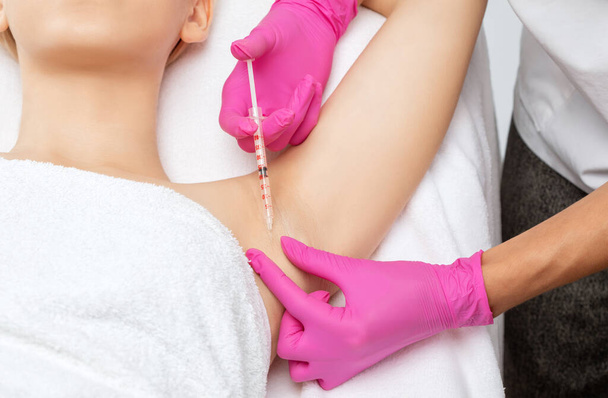 Lääkäri tekee injektioita botulinumtoksiinista käsivarren alueella liikahikoilua vastaan. Naisten kosmetiikka käsite. - Valokuva, kuva