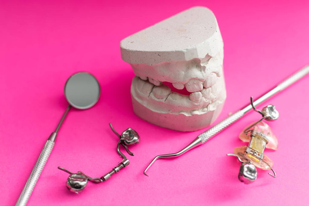 Modelo de gesso de fundição dentária gesso moldado laboratório protético de mandíbulas humanas estomatológicas. placa dental. - Foto, Imagem