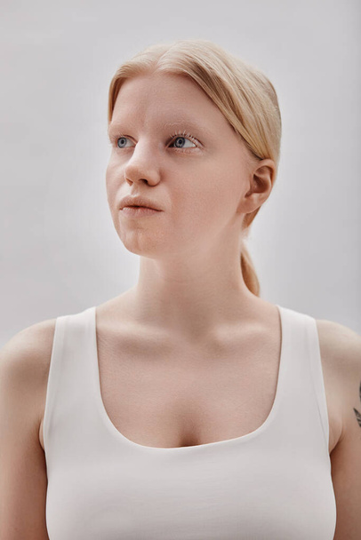 Minimal portrait of ethereal blonde girl with albinism posing against white background - Photo, Image