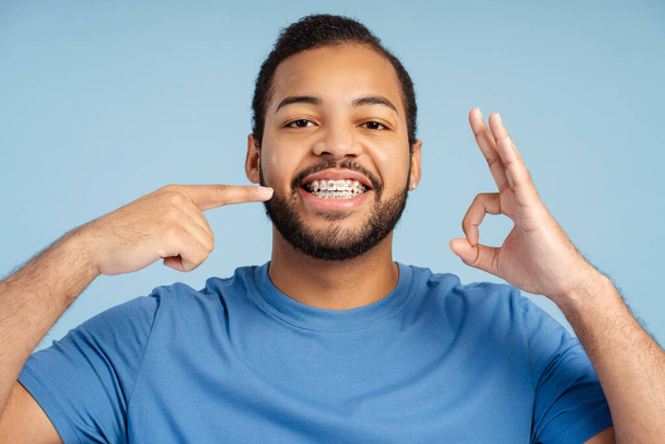 Χαμογελώντας βέβαιος άνθρωπος δείχνοντας τα δάχτυλα στα δόντια τιράντες, κοιτάζοντας κάμερα, δείχνει ok χειρονομία απομονώνονται σε μπλε φόντο. Υγεία, υγιεινή, ορθοδοντική έννοια  - Φωτογραφία, εικόνα