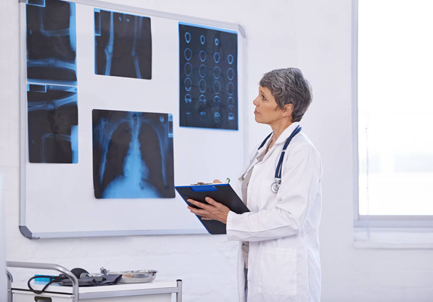 Senior doctor, woman and study xray with clipboard for checklist, assessment and radiology for surgery. Lungs, brain and bones with anatomy scan for healthcare, surgeon and treatment plan at clinic. - Photo, Image