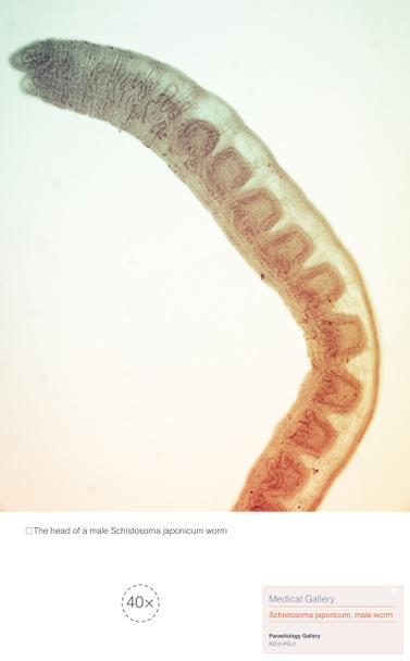 Schistosoma japonicum est un parasite qui provoque la schistosomiase humaine, et est principalement répandu en Asie, causant des dommages au foie humain et au système veineux porte. - Photo, image
