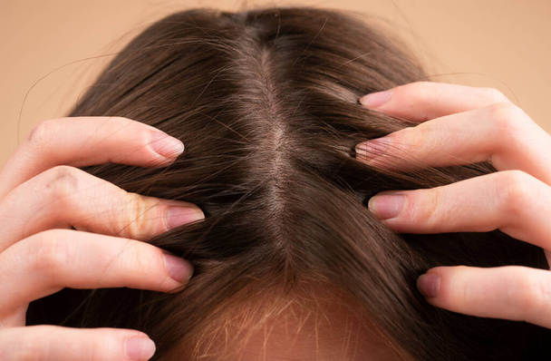 Concept of hair loss. Hair loss close up. tangled Problem hair - Zdjęcie, obraz