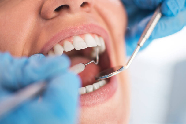 Abra la boca femenina durante el chequeo bucal en el dentista. Enfoque selectivo. - Foto, imagen