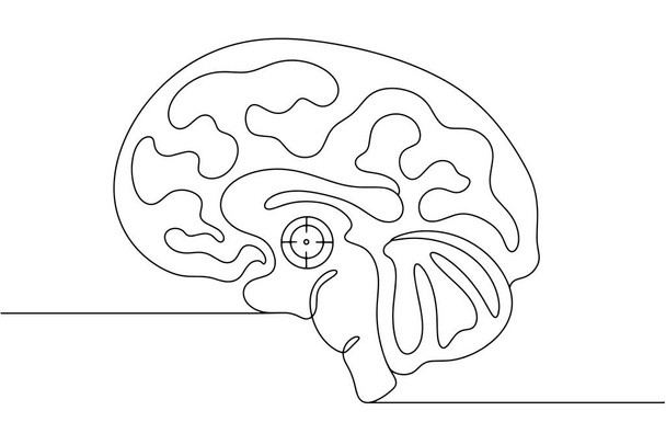 Das Gehirn eines Menschen mit Parkinson. Schädigung der Gehirnzellen in den Basalganglien. Organische Hirnschäden. Welt-Parkinson-Tag. Vektor. - Vektor, Bild