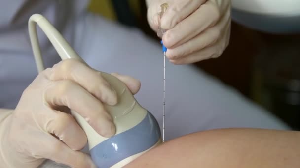 Amniyotik sıvı testi. Amniyosentez. Hamile bir kadının cenininin ultrason muayenesi. Ultrasonik tarayıcı. - Video, Çekim